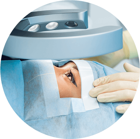 Cataract Surgery
